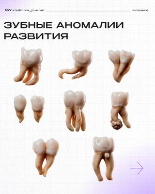 Зубные аномалии развития: диагностика и коррекция.